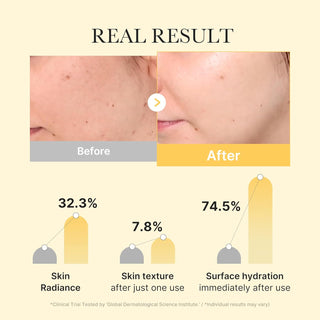 Mascarilla facial con cúrcuma y ácido kójico Gold Jelly Gel Mask - Medicube