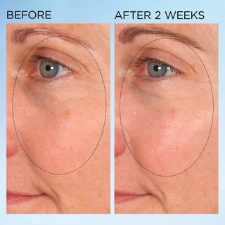 Cápsulas correctoras de manchas Visible Brightening Clearly Radiant - Elizabeth Arden