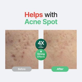 Serum facial Wonder Releaf Centella Serum - Purito