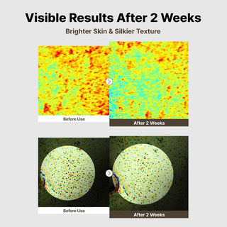Serum facial Alpha-Arbutin TXA Pure Tone Serum | Discoloration Care - NIDA