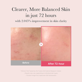 Serum facial TXA + Niacinamide 15% Serum - Medicube