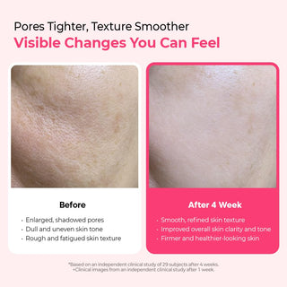 Serum facial Cyano Pink Spicule con Vitamina B12 & Niacinamida para poros dilatados - Dr. Melaxin