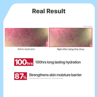 Ceramide Ato Lotion | Hidratante ligero para pieles secas y sensibles, repara la barrera cutánea - Illiyoon