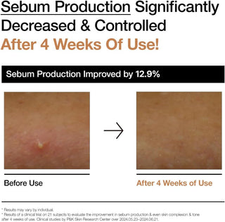 Tónico Facial Rice 70 Glow Milky Toner - Anua