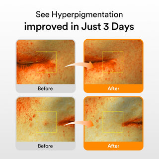 Serum Facial Glutathiosome Dark Spot Serum Vita drop - Abib