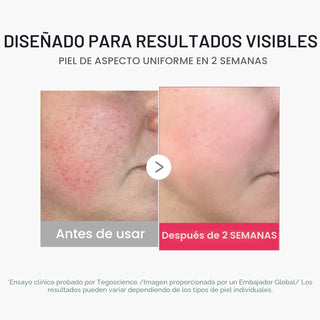 Booster Pro Mini Plus — terapia facial de alta tecnología - Medicube