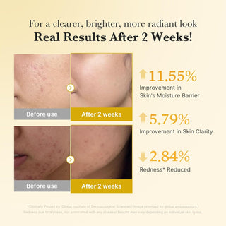 Serum facial Clarificante Kojic Acid Turmeric Capsule Serum - Medicube
