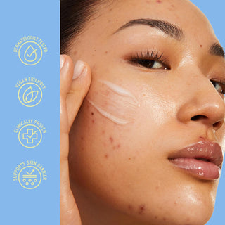 Crema facial Blemish Acne Control Moisturizer - BYOMA