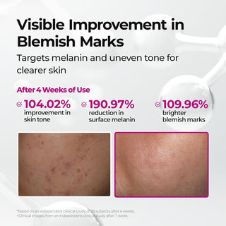 Serum facial Cemenrete Picotonic Shot: corrector de pigmentación con alfa-arbutina y niacinamida - Dr. Melaxin