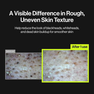 Mascarilla facial 2-Step Zero Pore Overnight Bubble Mask: Exfoliante y cuidado de la barrera cutánea - UNLEASHIA