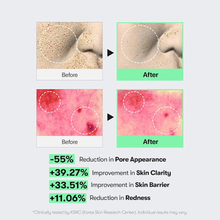 CICA Reedle Shot 100 — Sérum de microagujas con espículas y exosomas para el cuidado y la exfoliación de los poros - VT COSMETICS