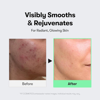 CICA Reedle Shot 100 — Sérum de microagujas con espículas y exosomas para el cuidado y la exfoliación de los poros - VT COSMETICS