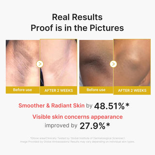 Exfoliante Corporal Kojic Acid Turmeric Body Peel Shot - Medicube