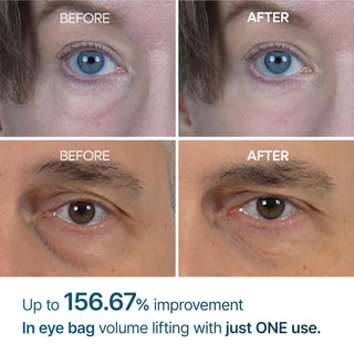 Eyephalt Eyebag Cream - Dr. Melaxin