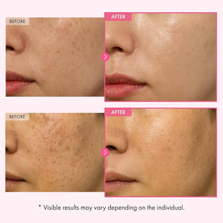 Crema facial Arbutin 7% Glutathione Cream - TOSOWOONG