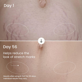 Crema Corporal B-FLAT Belly Firming Cream - MAËLYS