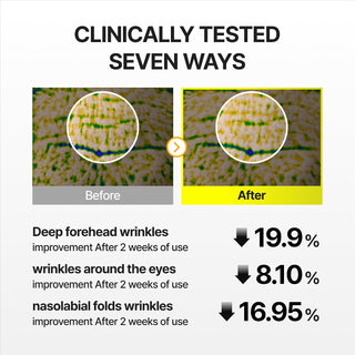The Vita-A Retinal Shot Tightening Dual Cream: retinoide de alta concentración antiedad y calmante - celimax