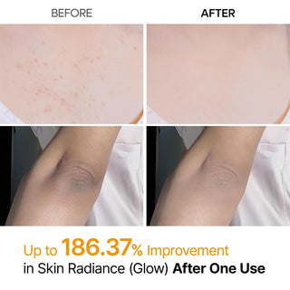 Exfoliante Corporal en Spray Peel Shot Kojic Acid Turmeric - Dr.Melaxin