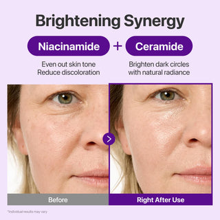 NAD+ Retinal 9+ Crema para el contorno de ojos - numbuzin