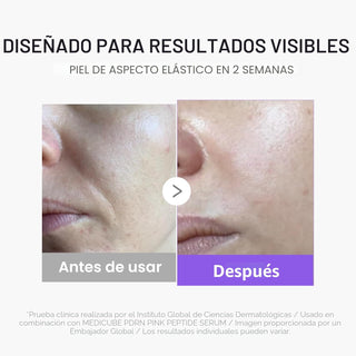 Booster Pro Mini Plus — terapia facial de alta tecnología - Medicube