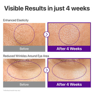 No.9 NAD+ Peptide Lifting Serum Facial - numbuzin