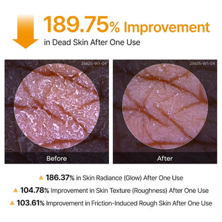 Exfoliante Corporal en Spray Peel Shot Kojic Acid Turmeric - Dr.Melaxin