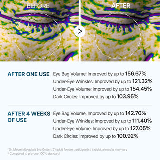 Eyephalt Eyebag Cream - Dr. Melaxin