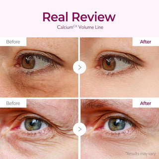 Parches de Calcio para el contorno de ojos reduce la hinchazón y las ojeras - Dr. Melaxin