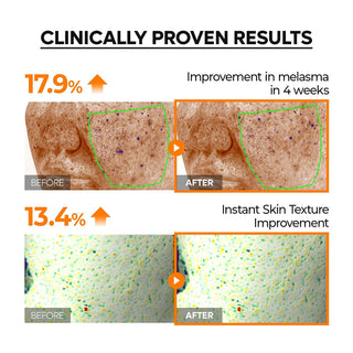 Serum Retinal Mela-C·E Ferulic — para piel apagada y sin luminosidad - Dr. Melaxin