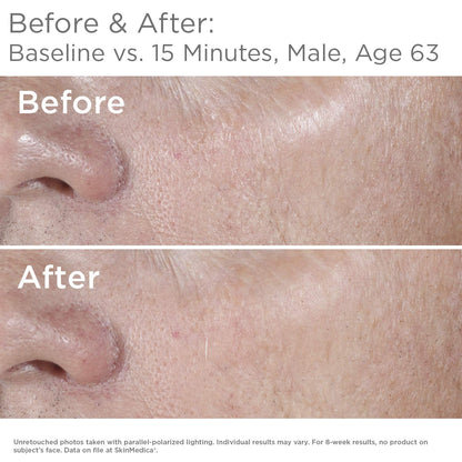 Serum Anti Age HA⁵® Rejuvenating - SkinMedica vista frontal con fondo blanco.