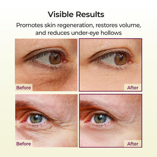 Multi Balm Wrinkles Calcium - Dr. Melaxin