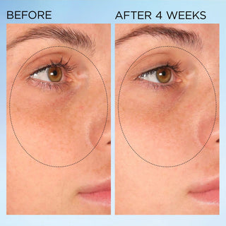 Cápsulas correctoras de manchas Visible Brightening Clearly Radiant - Elizabeth Arden