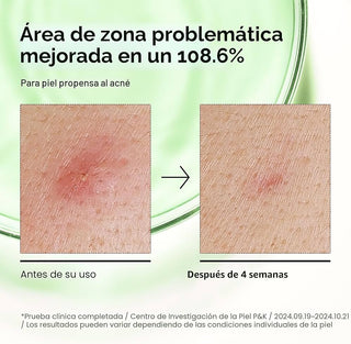 Serum Facial de Ácido Azelaico 10% Hialurónico - Anua