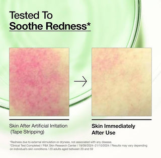 Serum Facial de Ácido Azelaico 10% Hialurónico - Anua