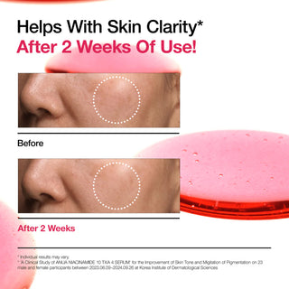 Serum NIACINAMIDE 10%+TXA 4% - Anua