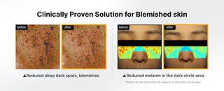 Crema facial Pore+Dark Spot Brightening - celimax