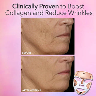 DRx SpectraLite™ FaceWare Pro 3-Minute LED Device - Dr. Dennis Gross Skincare