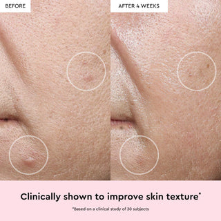 Serum Watermelon Glow Niacinamide Dew Drops - Glow Recipe