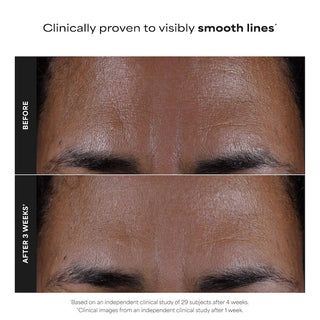Tónico Facial exfoliante con Ácido salicílico y té verde — Skin Perfecting 2% BHA Exfoliating - Paula's Choice