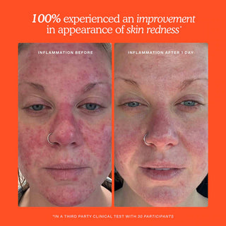 Bruma facial SOS Daily Rescue - Tower 28