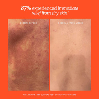 Bruma facial SOS Daily Rescue - Tower 28