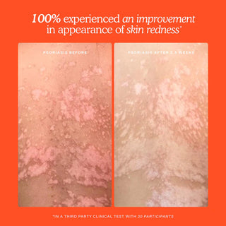 Bruma facial SOS Daily Rescue - Tower 28