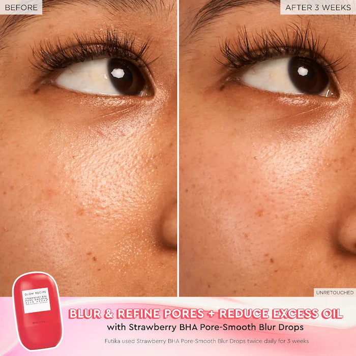 Gotas difuminadoras de poros Strawberry BHA Pore-Smooth Blur Drops™ - Glow Recipe vista frontal con fondo blanco.