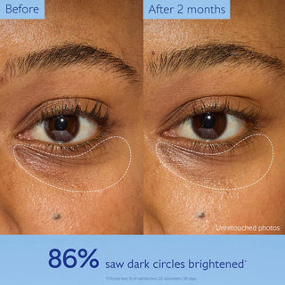 Crema contorno de ojos iluminadora con Niacinamida Vinoperfect - Caudalie