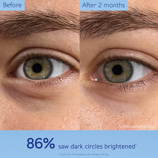 Crema contorno de ojos iluminadora con Niacinamida Vinoperfect - Caudalie