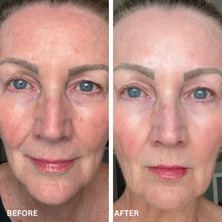 CryoGlow™ Cooling + LED Face Mask & Facial Glow - Shark Beauty