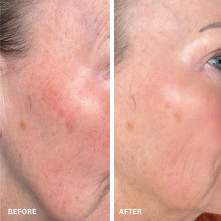 CryoGlow™ Cooling + LED Face Mask & Facial Glow - Shark Beauty
