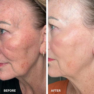 CryoGlow™ Cooling + LED Face Mask & Facial Glow - Shark Beauty