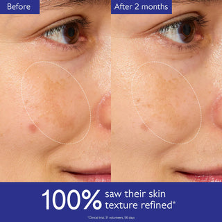 Vinoperfect Esencia glicólica iluminadora - Caudalie