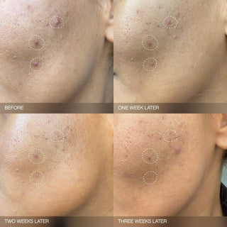 Set iluminador Faded para la decoloración en rostro y cuerpo - Topicals